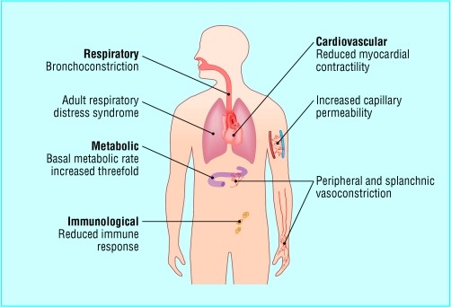 Systemic response to burns